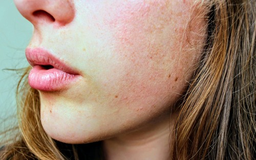 A close-up of a woman's face showcasing her freckles